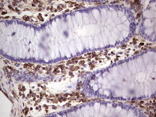 Peripherin Antibody (clone OTI1E10)