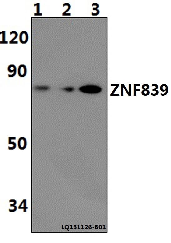 Polyclonal Rabbit anti-Human C14orf131 / ZNF839 Antibody (WB)