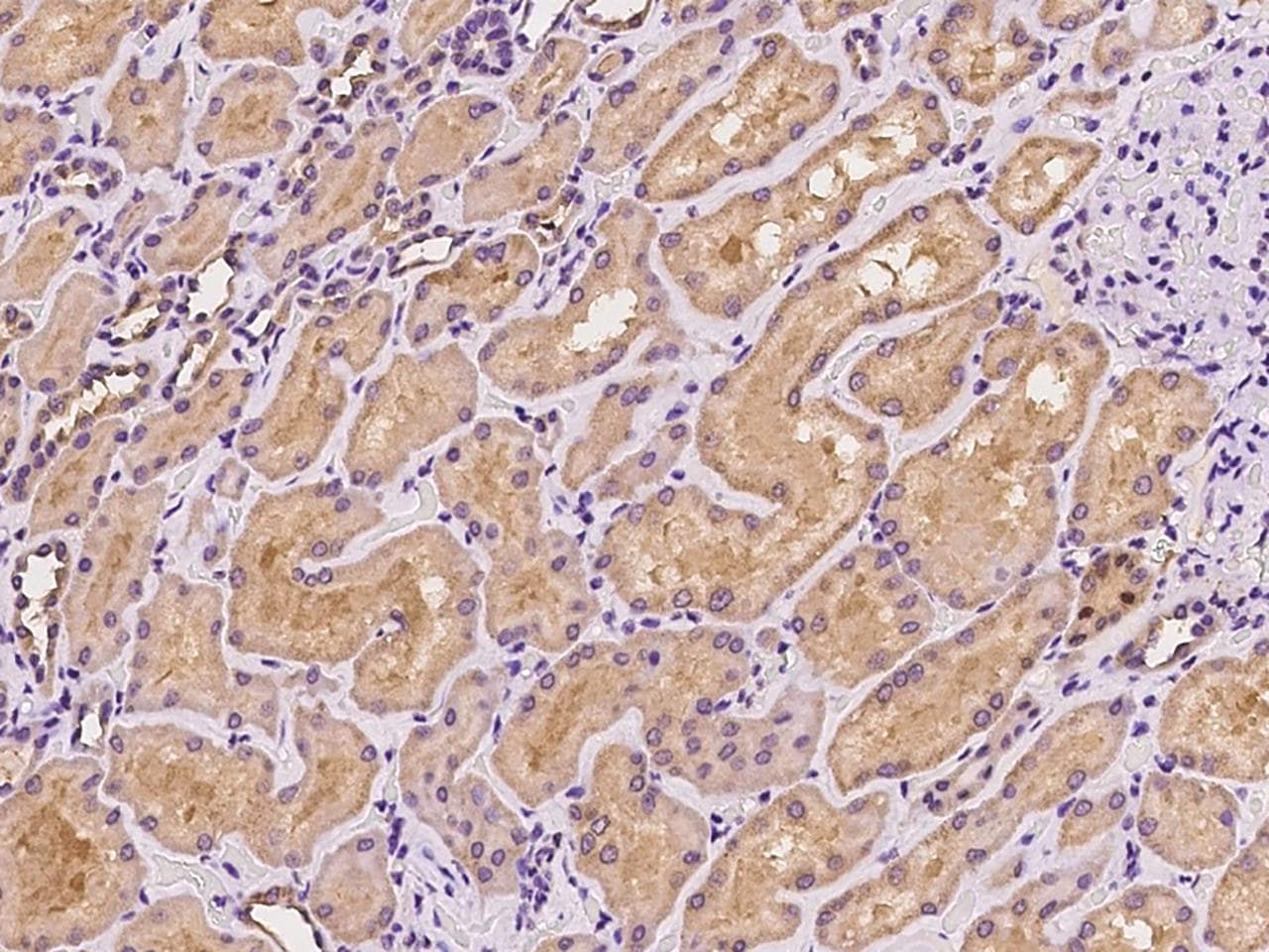 SLC9A7 Antibody