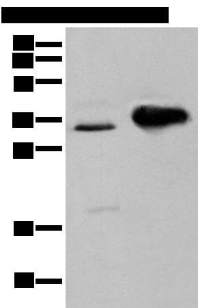 ATP6V1E2 Antibody