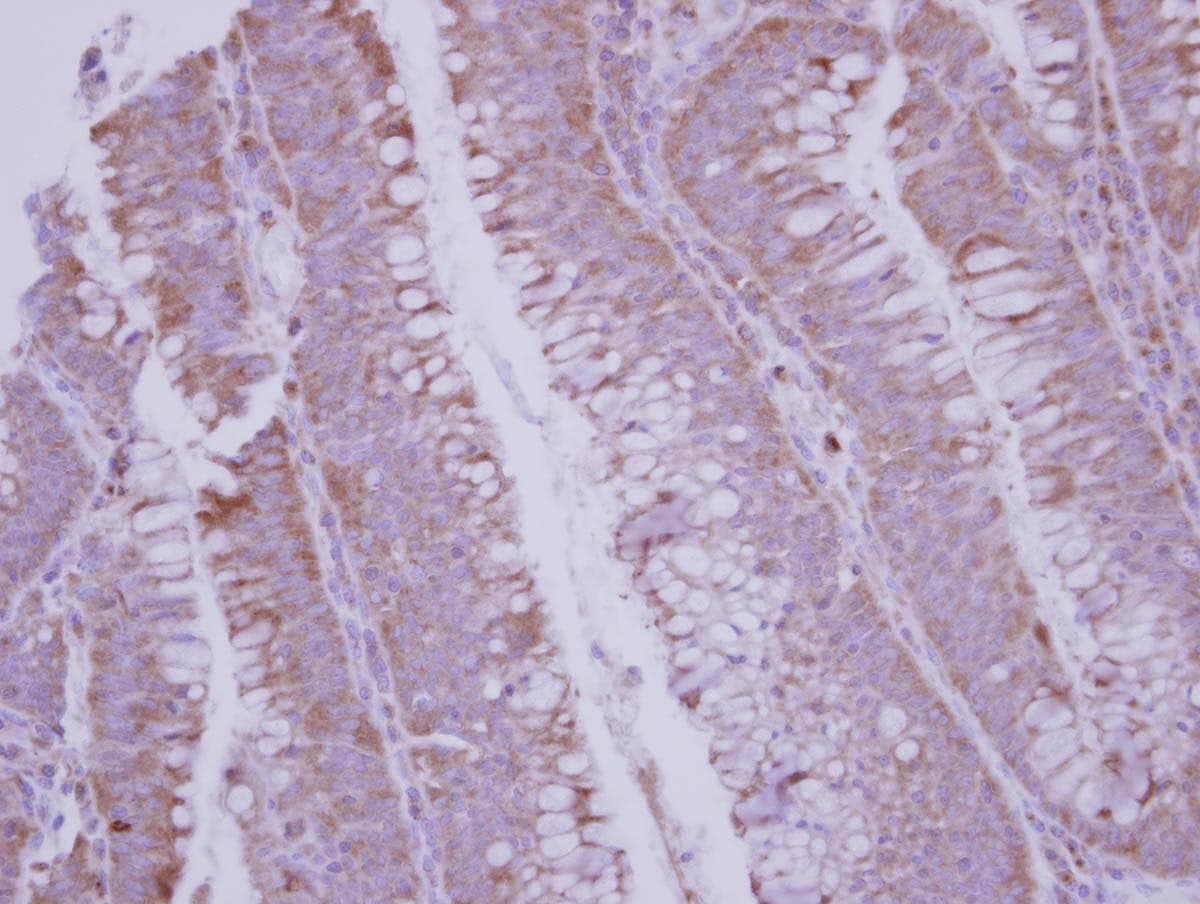 Polyclonal Rabbit anti-Human BMP10 Antibody (C-Terminus, IHC, WB)