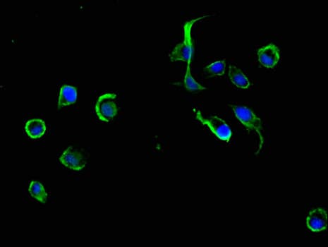 Polyclonal Rabbit anti-Human ADRM1 Antibody (IHC, IF, WB)