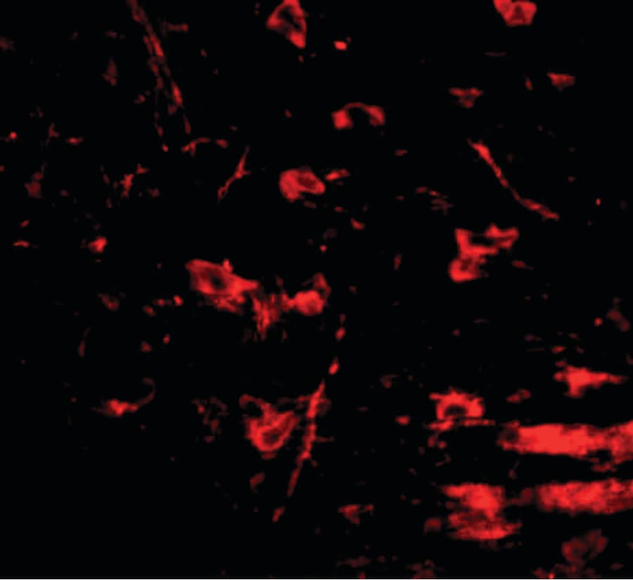 IHC-plus™ RCAN2 / RCN2 Antibody