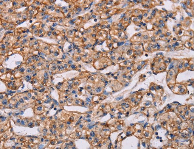 CENTD2 / ARAP1 Antibody