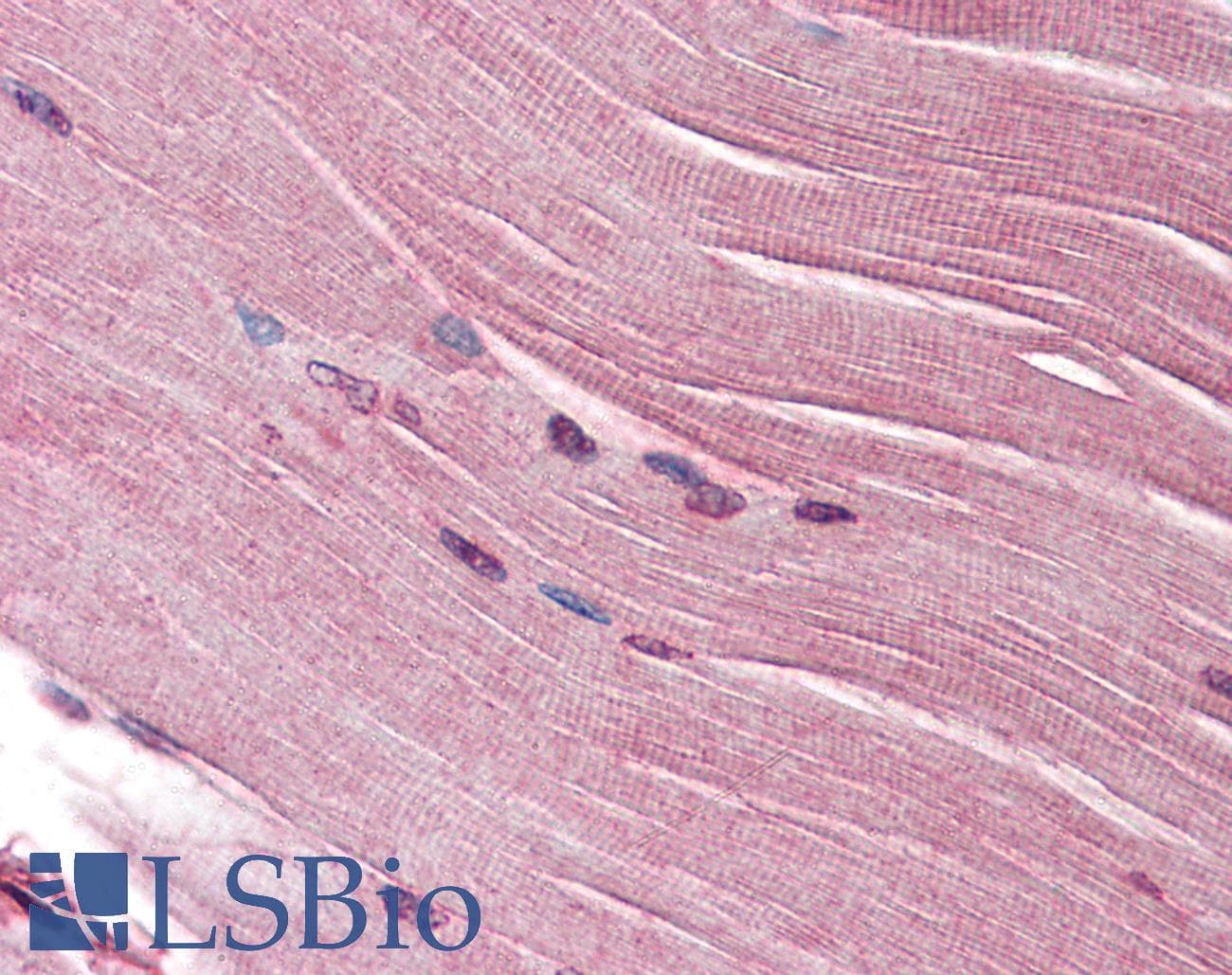IHC-plus™ SH3GLB1 / Bif / Endophilin B1 Antibody
