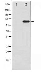 PRKCZ / PKC-Zeta Antibody