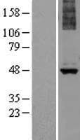 ALG1 Protein (Over-Expression Lysate Myc-DDK (Flag))