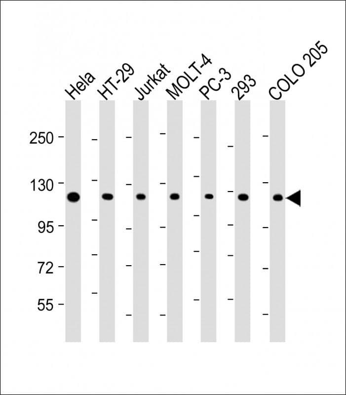 IHC-plus™ TERT / Telomerase Antibody (aa627-656)