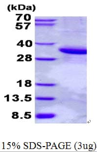 Human Scramblase / PLSCR1 Protein (Recombinant His)