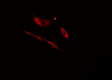 RPL17 / Ribosomal Protein L17 Antibody