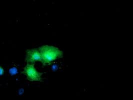 Thymidylate Kinase Antibody (clone OTI2D1, Carrier-free)