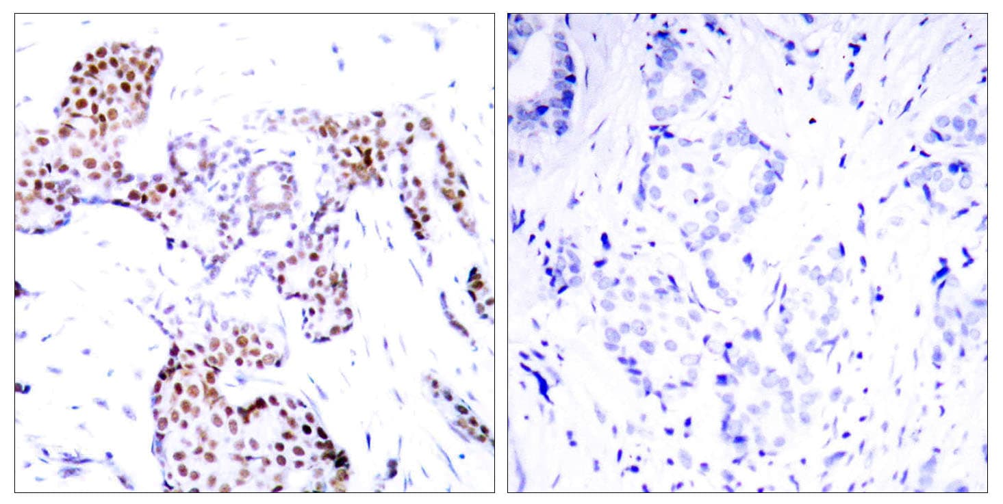 ELK1 Antibody (phospho-Ser389)