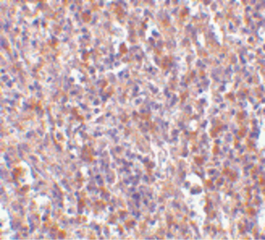 Polyclonal Rabbit anti-Human TMEM142A / ORAI1 Antibody (IHC, IF, WB)