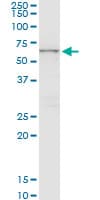 IHC-plus™ CTNS / Cystinosin Antibody (clone 5G6)