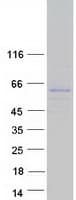Human SH2D7 Protein (Recombinant Myc-DDK (Flag))