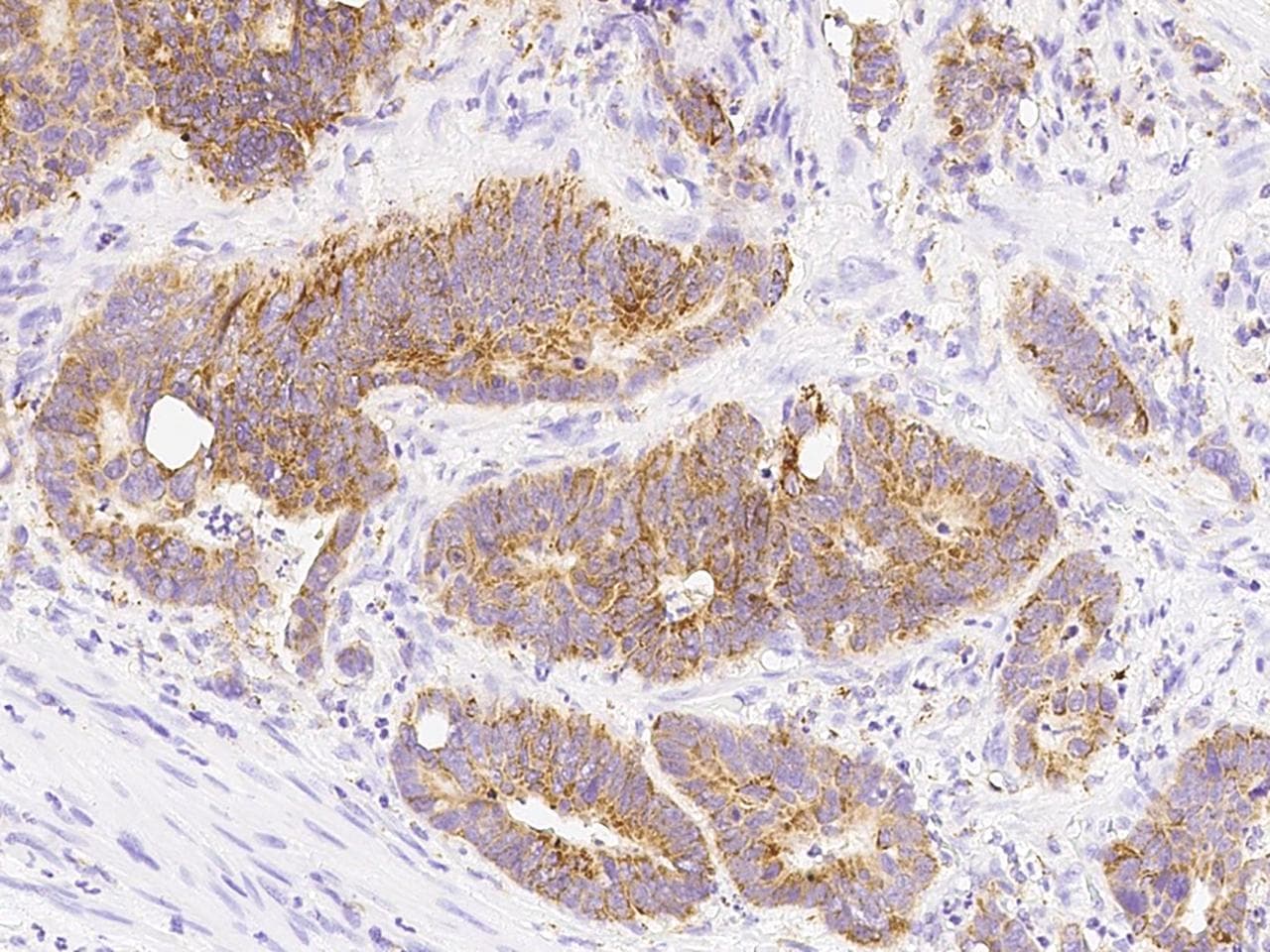 PPIF / Cyclophilin F Antibody (Preservative Free)