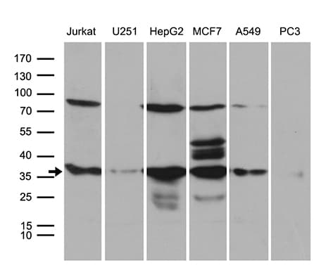 Monoclonal Mouse anti-Human PPP4C Antibody (clone OTI2H7, Carrier-free, IHC, WB)