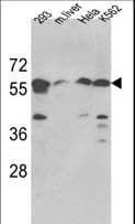 SPTLC1 / HSN1 Antibody (aa26-57)