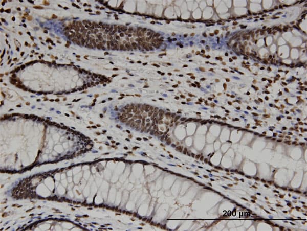 CTDP1 / FCP1 Antibody (clone 3G4)