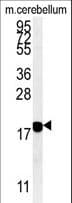 SNCB / Beta-Synuclein Antibody (aa93-122)