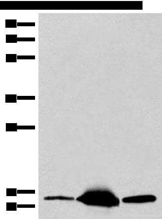Polyclonal Rabbit anti-Human COX6A2 Antibody (WB)