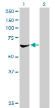 IHC-plus™ RPS6KB2 / S6K2 Antibody (clone 4B11)