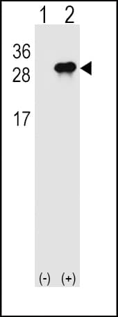 Polyclonal Rabbit anti-Human IL28B Antibody (aa34-63, WB)