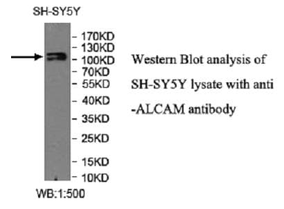 Polyclonal Rabbit anti-Human ALCAM / CD166 Antibody (C-Terminus, WB)