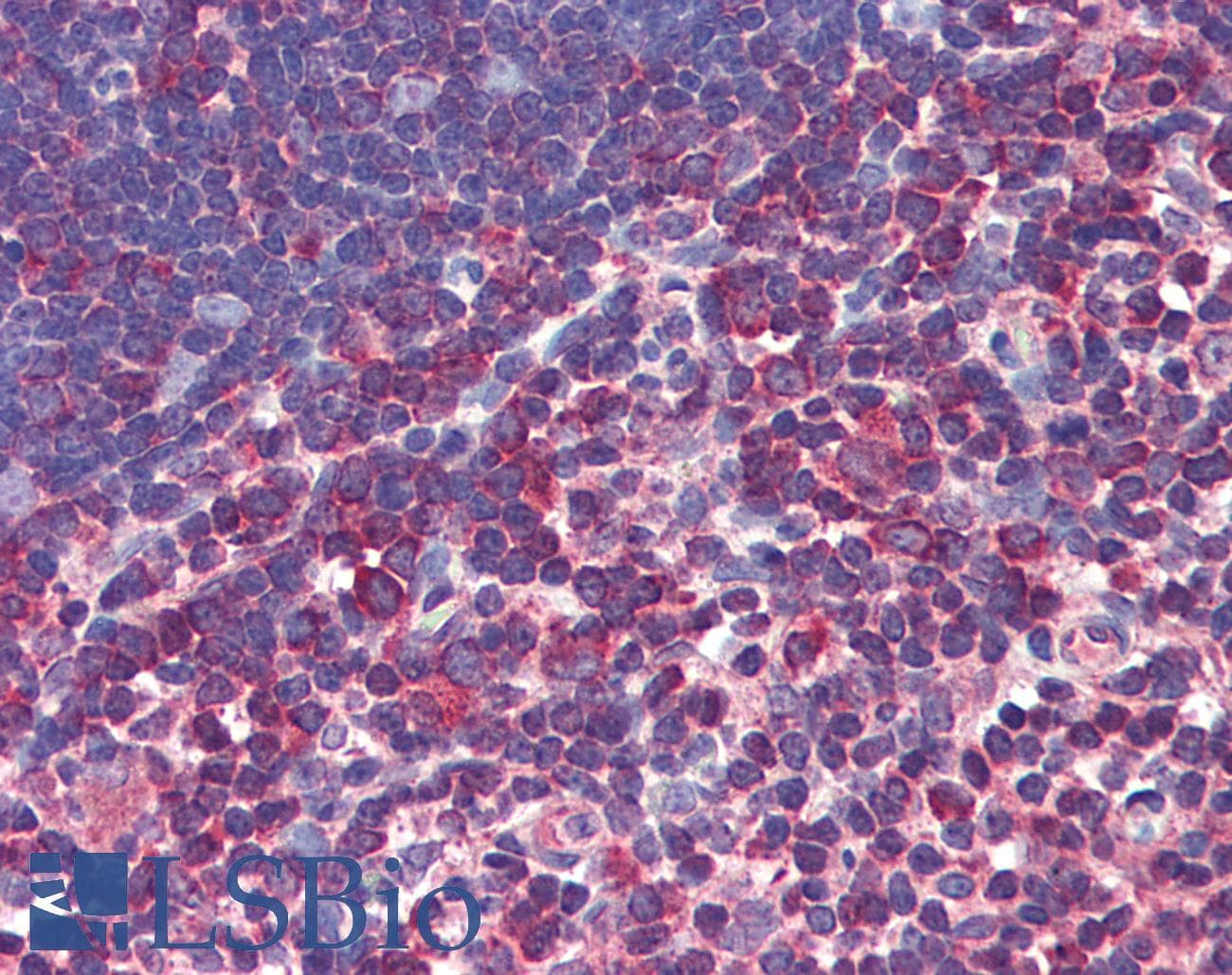 IHC-plus™ Polyclonal Rabbit anti-Human CASP8 / Caspase 8 Antibody (IHC, WB)