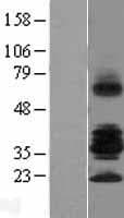 RSPO3 Protein (Over-Expression Lysate Myc-DDK (Flag))