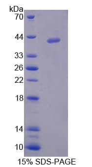 Mouse ARH / LDLRAP1 Protein (Recombinant His)