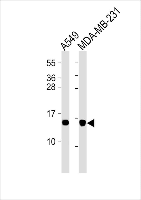 RPL30 / Ribosomal Protein L30 Antibody