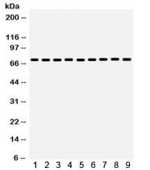 Polyclonal Rabbit anti-Human HSPA8 / HSC70 Antibody (IHC, WB)