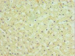 Polyclonal Rabbit anti-Human HYAL1 Antibody (aa136-435, IHC, WB)