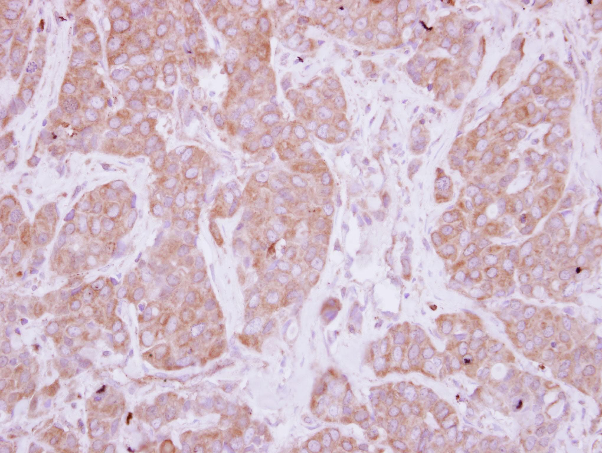 PPEF / PPEF1 Antibody