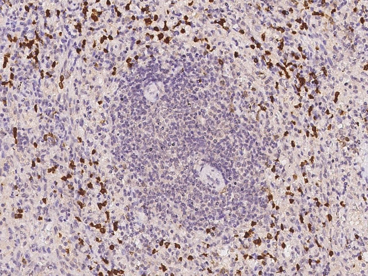 Polyclonal Rabbit anti-Human PRAM1 Antibody (IHC)