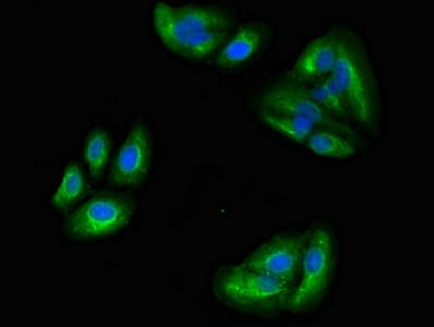 Polyclonal Rabbit anti-Human MAPRE2 / EB2 Antibody (IF, WB)