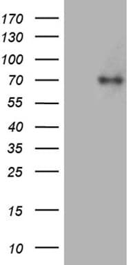 ACS5 / ACSL5 Antibody (aa104-620, clone OTI3A3)