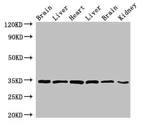 MBP / Myelin Basic Protein Antibody