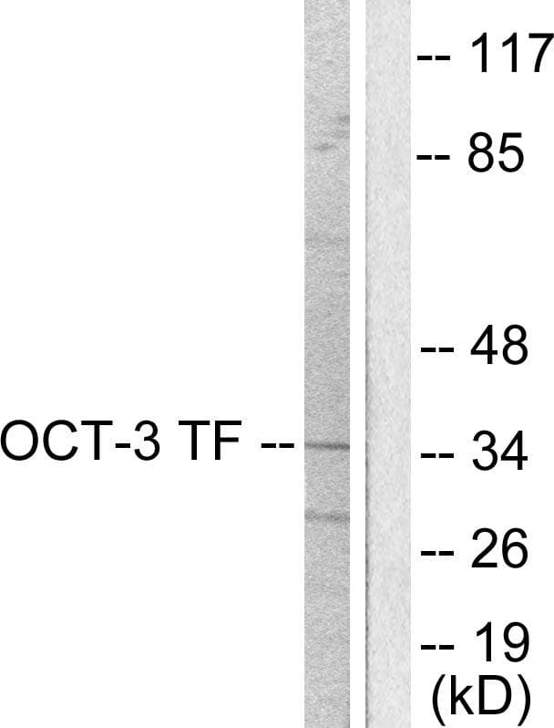 SLC22A3 / OCT3 Antibody