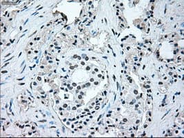 BRAF / B-Raf Antibody (clone OTI4C11)
