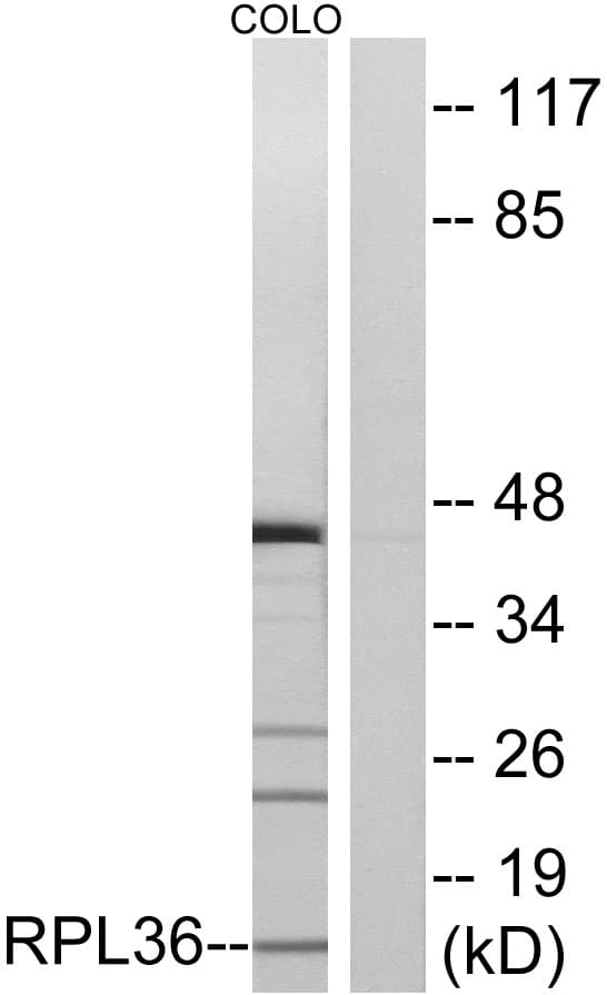 RPL36 / Ribosomal Protein L36 Antibody (aa51-100)