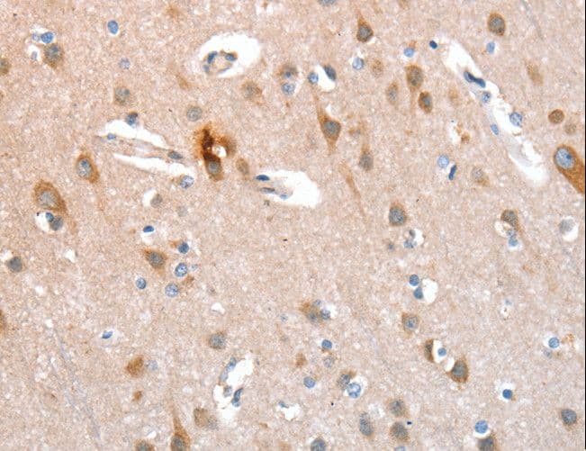 KEL / CD238 Antibody
