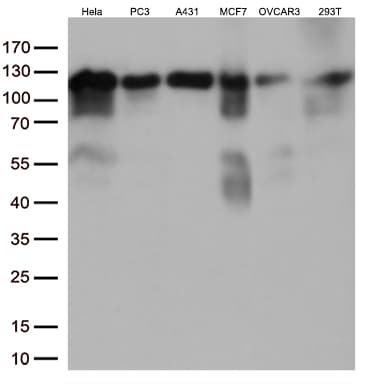 Monoclonal Mouse anti-Human TRIM28 / KAP1 Antibody (clone OTI5E10, IHC, IF, WB)