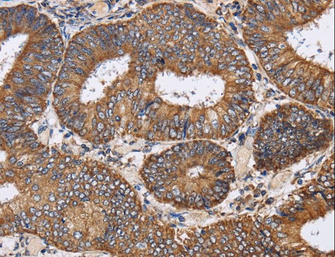 PDGF-CC Antibody