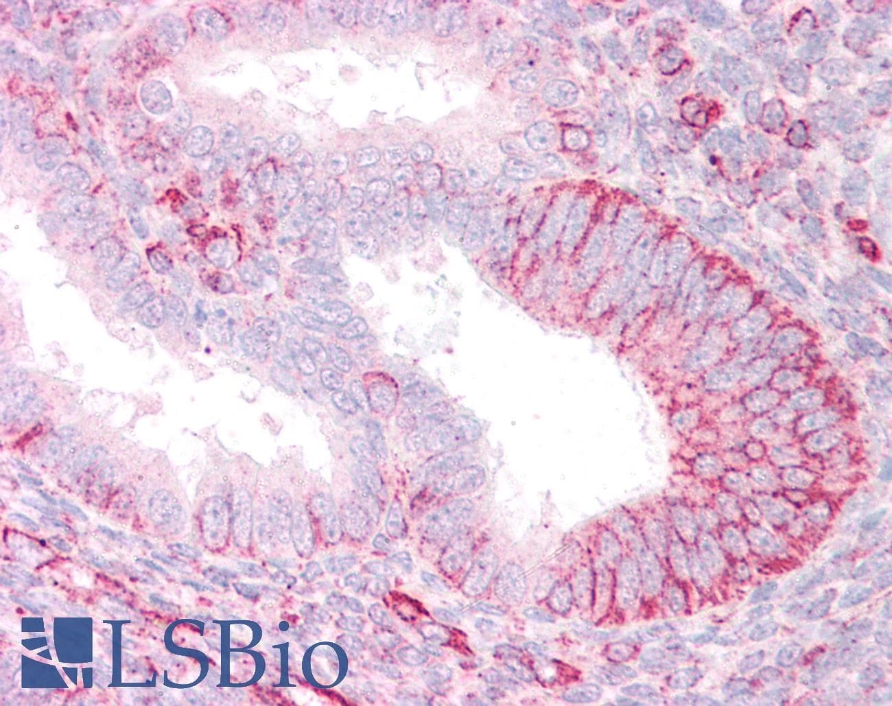 IHC-plus™ TRIM39 / RNF23 Antibody (aa475-488)