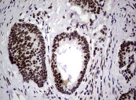 NBN / Nibrin Antibody (clone OTI6H7)