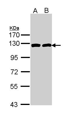 ACLY / ATP Citrate Lyase Antibody