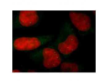 SMN1 Antibody (clone 2B1)