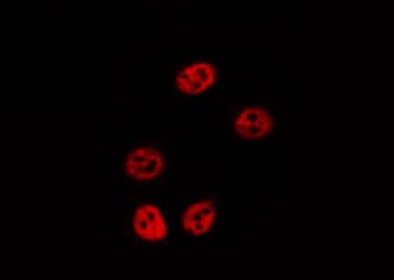 ALOX5 / 5-LOX Antibody